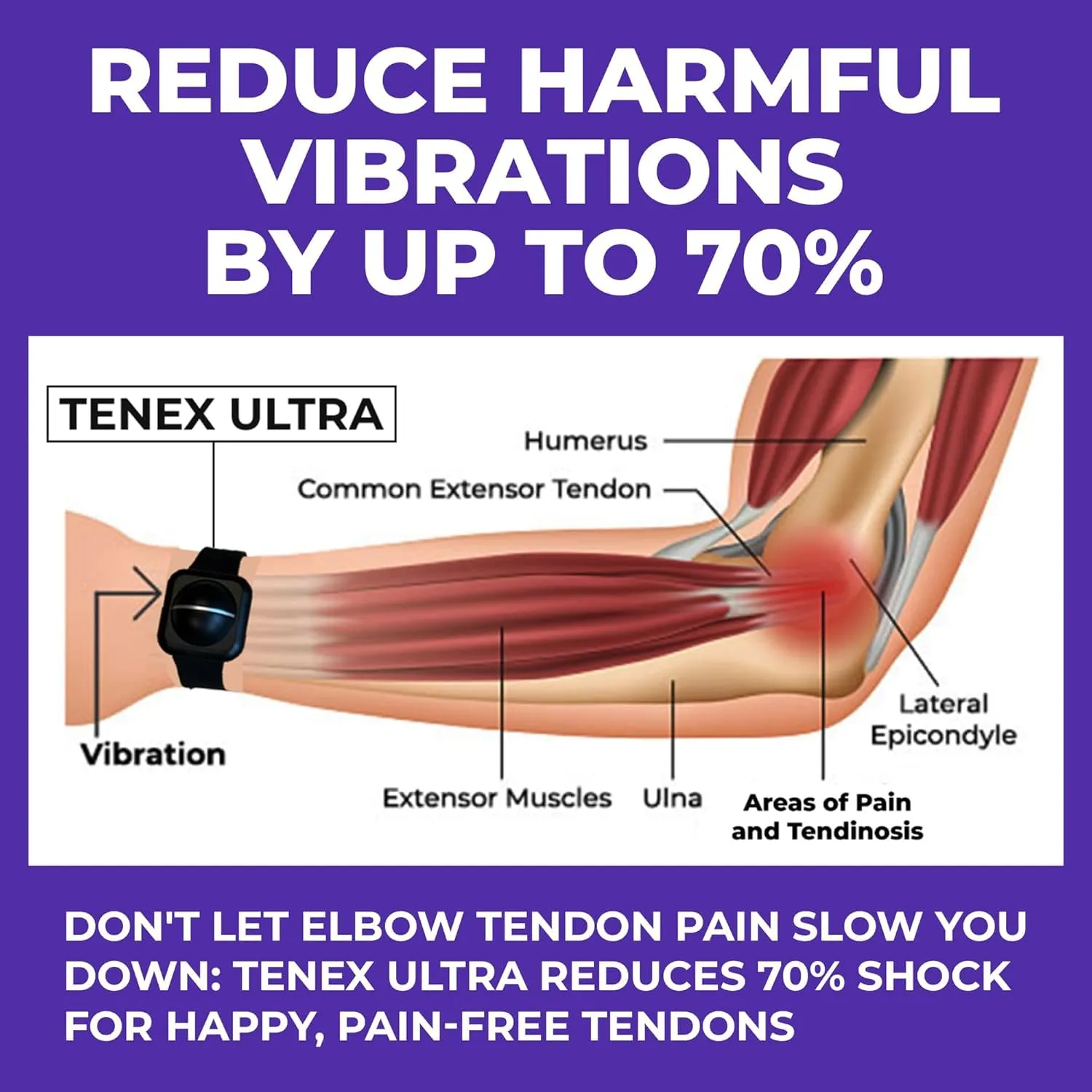 TENEX ULTRA Tennis Elbow Brace for Men and Women, Wrist-Worn Counterforce Band for Golfers Elbow, Non-Compression Relief Device, Tennis Elbow Sleeve Alternative, Elbow Pain Support, Waterproof